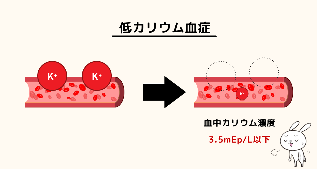 低カリウム血症 どんな症状 原因は イラストで分かりやすく解説 おがちゃん先生 Yahoo Japan クリエイターズプログラム